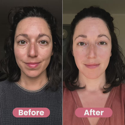 Contura Facial Sculptor + Light Therapy